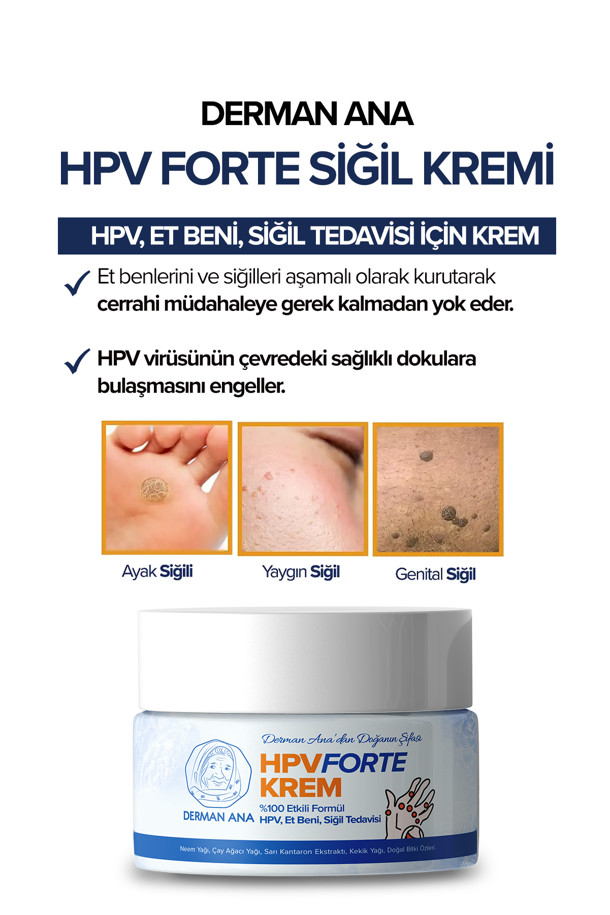 Derman Ana HPVFORTE Kremi